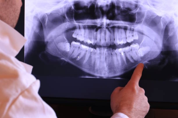Best Pediatric Emergency Dentist in Manchester, WA