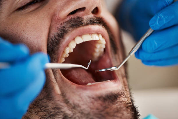 Best Emergency Gum Treatment in Manchester, WA