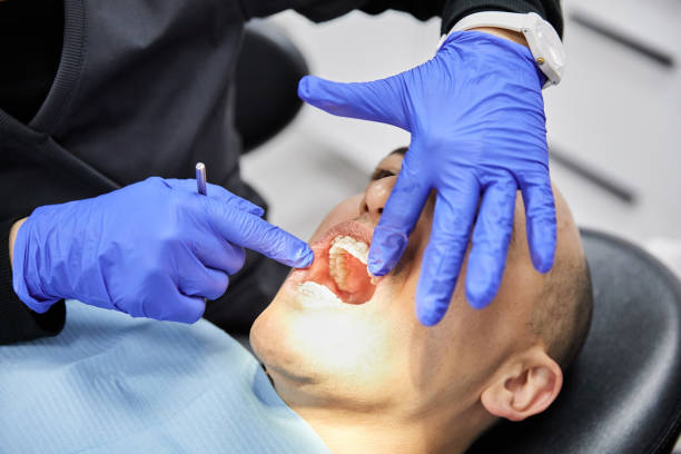 Best Emergency Wisdom Teeth Removal in Manchester, WA