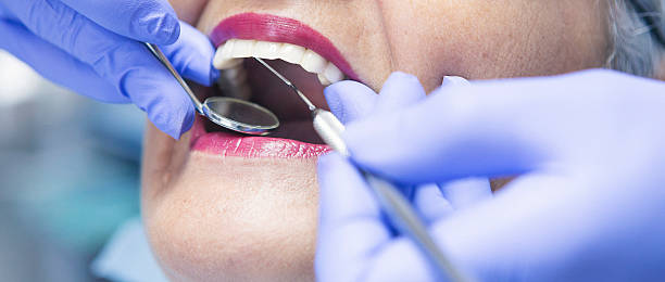 Best Emergency Denture Repair in Manchester, WA
